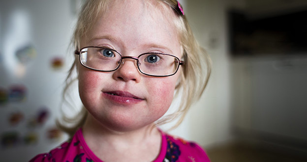 Only Person in the World with Rarest Condition is Three-Year-Old