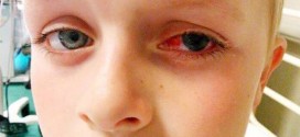 Boy Blinded by Loom Band