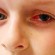 Boy Blinded by Loom Band