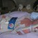 Cooling Babies Helps Reduce Long-Term Brain Damage