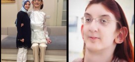World’s Tallest Teen